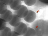 Characterization of Solder Defects in Package on Package