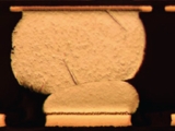 Head-On-Pillow Defect - A Pain in the Neck