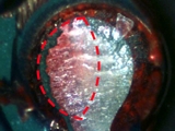 Reliability Impact of Partial Pad Craters