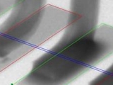 2D and CT Scan X-ray for Joint Inspection